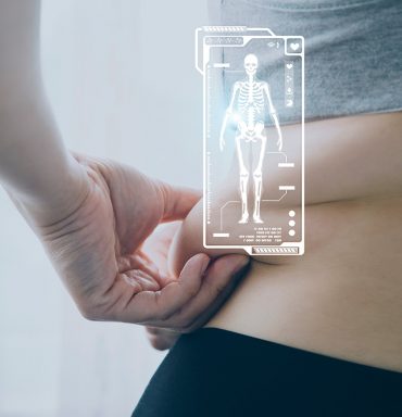 Diet, pills, gastric balloon, or surgery — how to treat obesity?